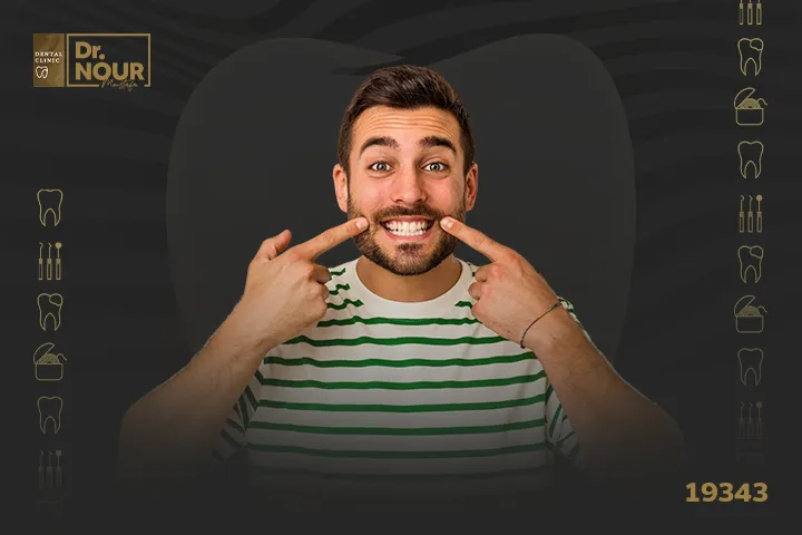 انواع تجميل الاسنان