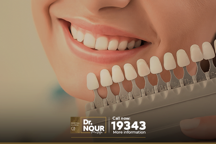 تجميل وتبييض الاسنان بالقشرة التجميلية دون المساس بالاسنان تماما
