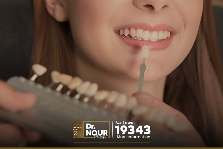 كل ما تريد معرفته عن العدسات اللاصقة للأسنان