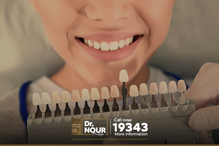 تبييض الاسنان الفوري بالقشرة التجميلية في أقل من 3 ساعات