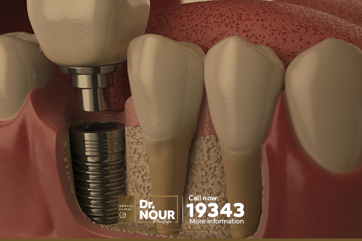 مشاكل تبديل الاسنان عند الاطفال