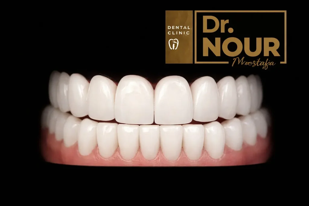 شكل أسنان الزيركون