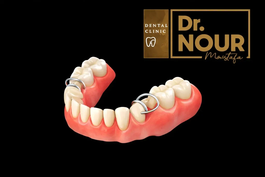 شكل تركيبة الأسنان المتحركة