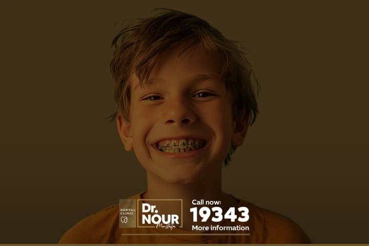 تقويم الاسنان للاطفال