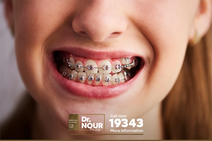 مراكز تقويم الاسنان